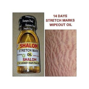 Shalom Stretch Marks Removal Oil 1pc